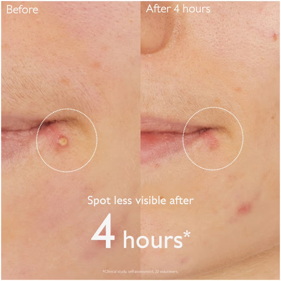 Caudalie Vinopure Salicylic Spot Solution