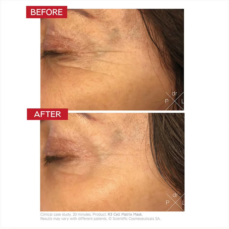 Dr. LEVY Switzerland R3 Cell Matrix Mask 50ml