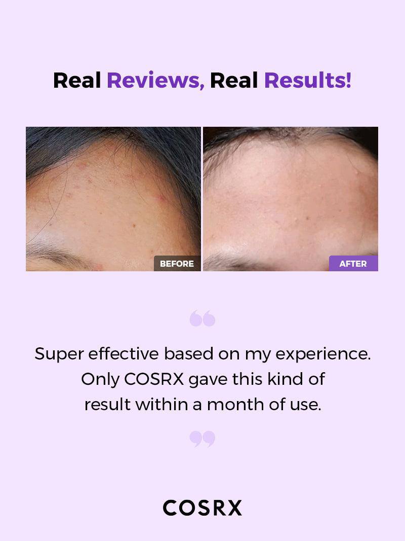 COSRX - تونر معالج لتنقية البشرة من حمض ألفا هيدروكسي/حمض بيتا هيدروكسي