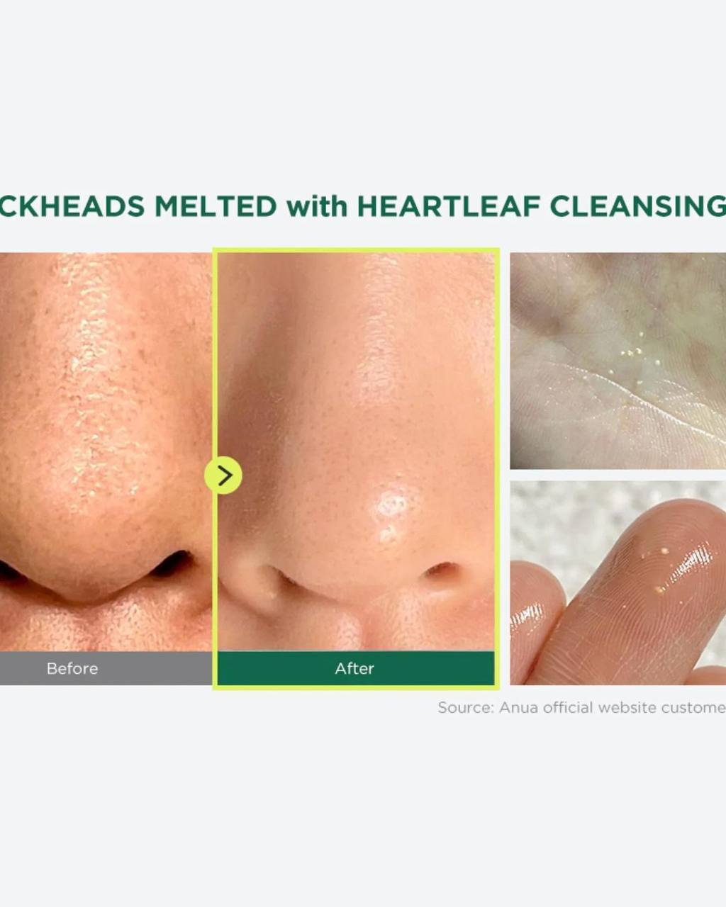 Anua - Heartleaf Pore Control Cleaning Oil