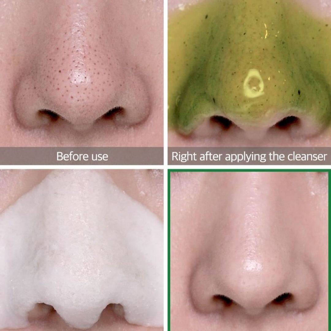 SOME BY MI - BYE BYE blackhead cleaner